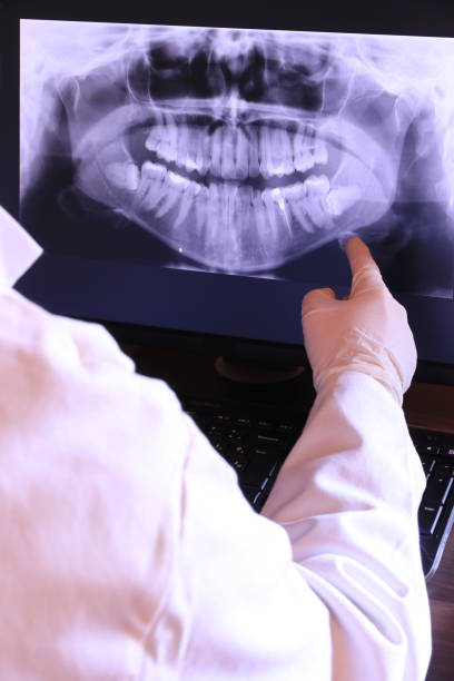 Best Emergency Gum Treatment in Orwell, OH